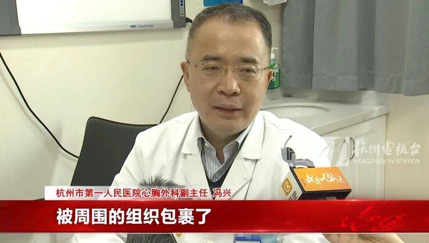 17岁小伙参军体检发现胸腔内有根5cm缝衣针,父母回忆或是1岁时扎入,取出时已锈迹斑斑