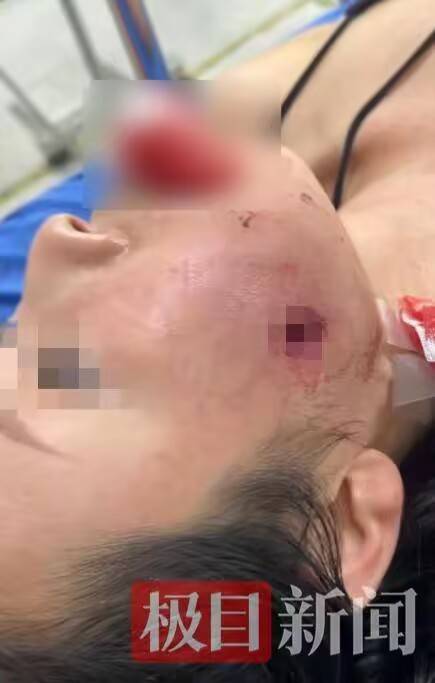 我总领馆就“中国游客在泰国脸部中弹”发布提醒,伤者女儿:母亲住院只能吃流食,伤口恢复还需3个月,将起诉索赔
